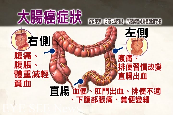 大腸癌症狀(資料來源:防癌之聲雜誌,馬偕大腸癌手冊) 大腸癌症狀(資料來源:防癌之聲雜誌,馬偕大腸癌手冊)