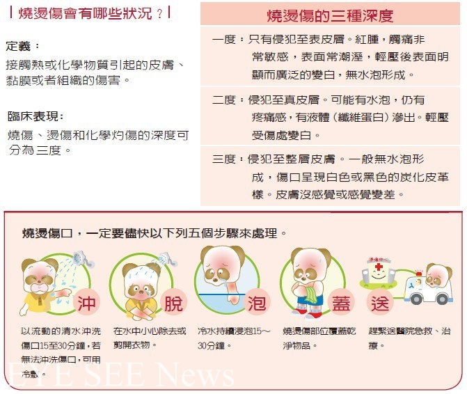 燒燙傷的分級及緊急處置! 圖/網路
