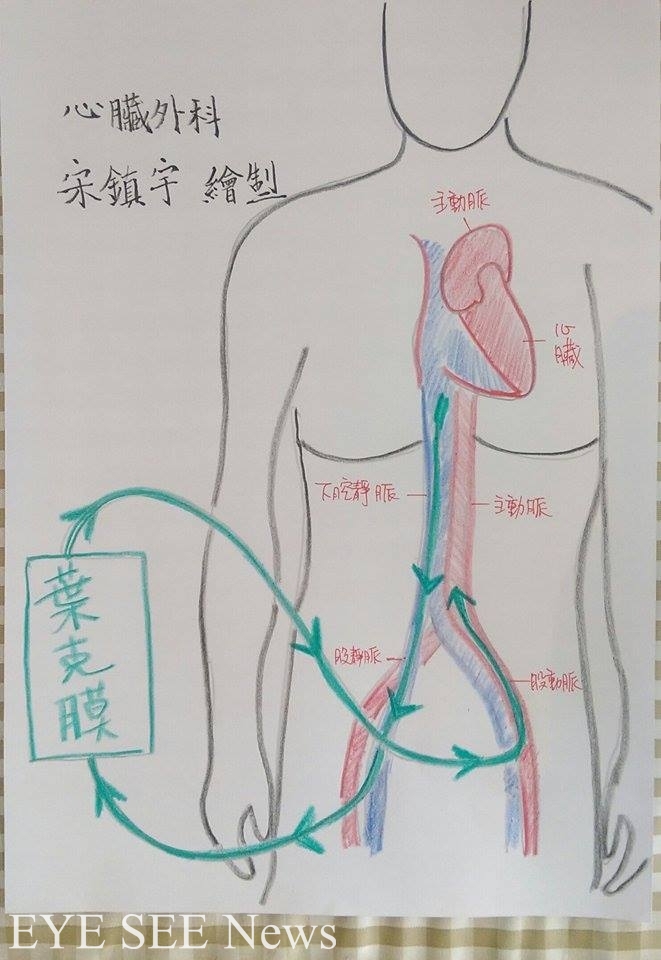 葉教授擺放的方式!(圖: 宋鎮宇醫師手繪提供)