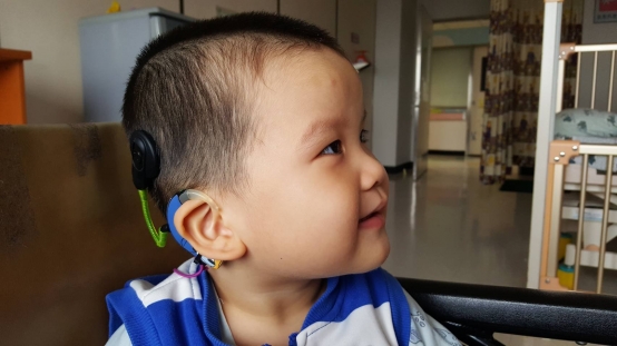 研究顯示雙耳聆聽對重度聽損學童的學習更有助益。圖／長庚醫院
